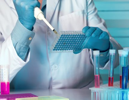 Colorimetric ELISA - AP Substrate