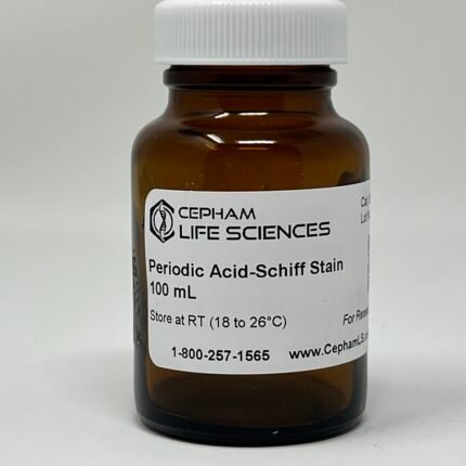 Periodic Acid-Schiff stain